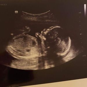 Meet your Posher, Max